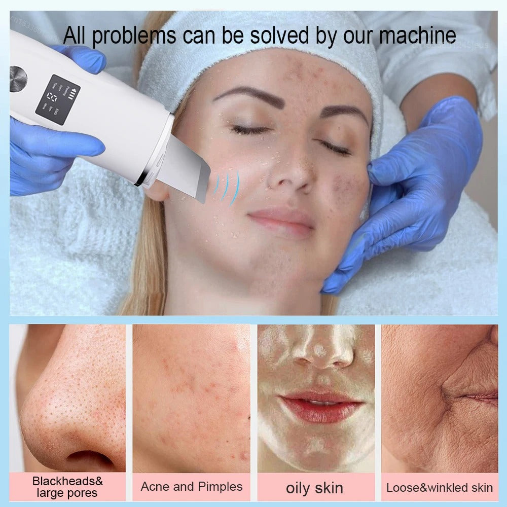 Finitecube™ Ultrasonic Face Scrubber